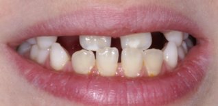 Prima del trattamento