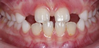 Prima del trattamento