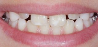 Risultato del trattamento