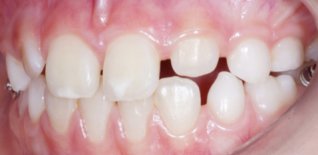 Risultato del trattamento