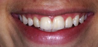 Risultato del trattamento