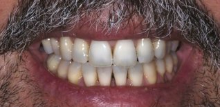 Risultato del trattamento