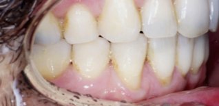 Risultato del trattamento