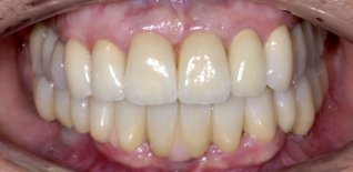 Risultato del trattamento