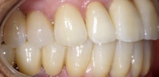 Risultato del trattamento