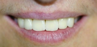 Risultato del trattamento