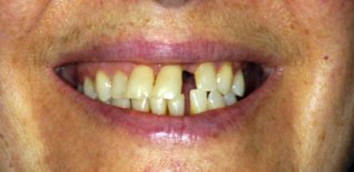 Prima del trattamento