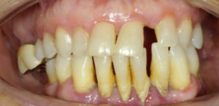 Prima del trattamento